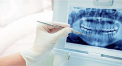 Save Your Smile with Cosmetic Dentistry